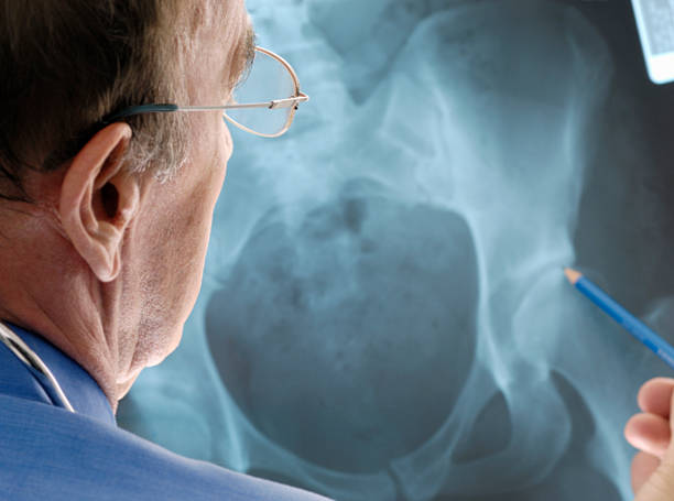 surgeon pointing at x-ray of a hip