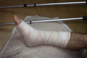 Selective shot of broken leg in a cast and crutches