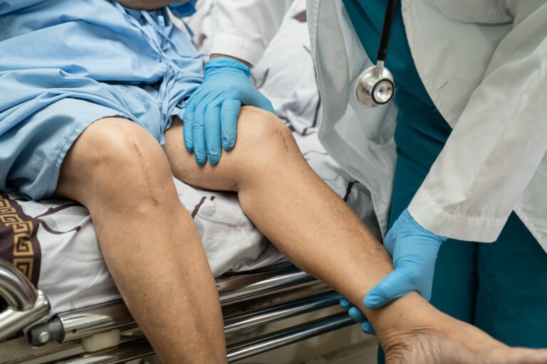 Orthopedic doctor Checking patient after Knee Surgery