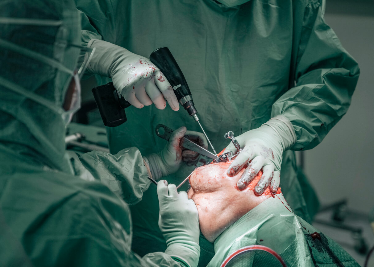 Orthopedic surgeons in operating room at hospital