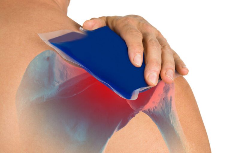 The hand of a person holding a cool gel pack on their shoulder to reduce rotator cuff tear pain.