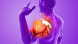Animation of Painful Shoulder
