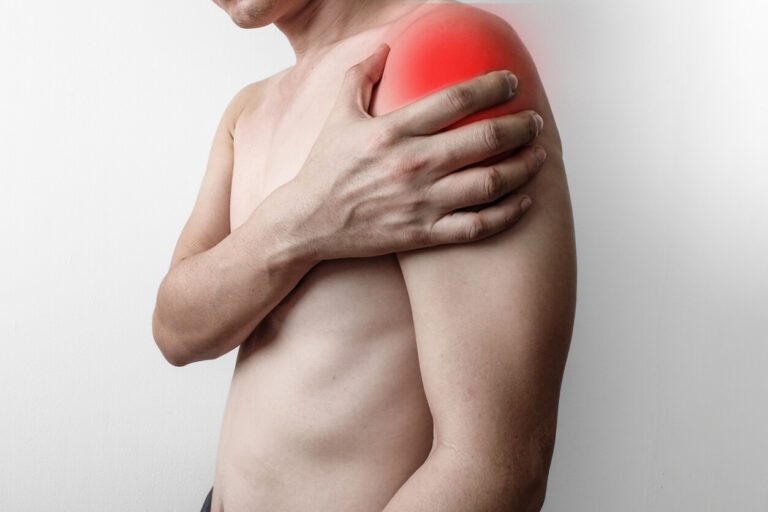 Man has shoulder pain from a torn rotator cuff, and on the shoulder there is an inflamed point from the muscles and tendons in the shoulder.
